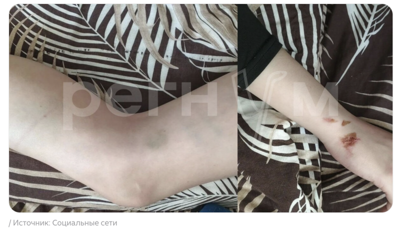 "Стыдно, что не смог постоять за себя": Избитый 53-летним "чудовищем" школьник морально сломлен. Мать рассказала о переживаниях подростка