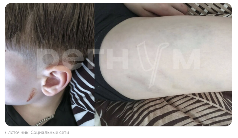 "Стыдно, что не смог постоять за себя": Избитый 53-летним "чудовищем" школьник морально сломлен. Мать рассказала о переживаниях подростка