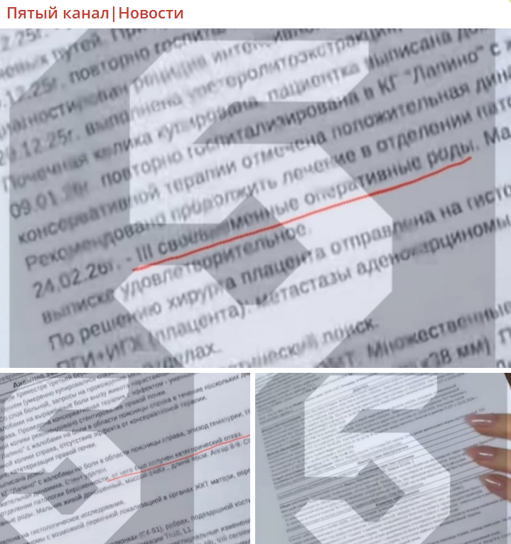 "Получен категорический отказ": В документах Лерчек о прохождении химиотерапии нашли нечто странное