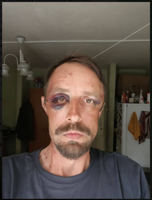 "Тогда порядок наведётся": Нападение таджиков на детский лагерь на Байкале стало последней каплей. Стешин нашёл способ приструнить мигрантов