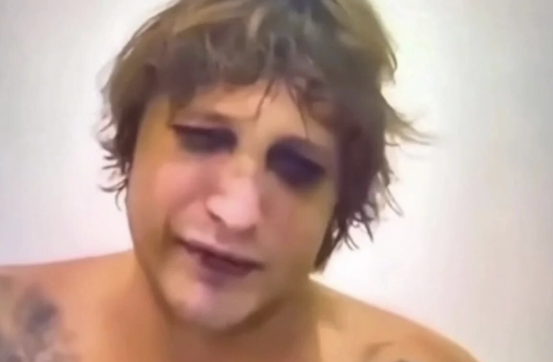 "Верните меня домой, то, что от меня осталось": Сеть "взорвали" шокирующие кадры — сын украинского авторитета молит о пощаде перед смертью