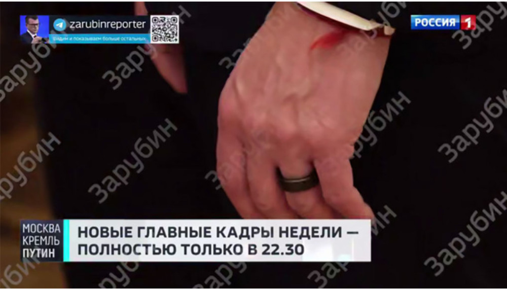 "Особого стресса не было": Кушнер и Грюнбаум пришли на встречу с Путиным в "умных кольцах"