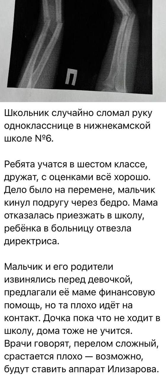 Как снять мерки для бюстгальтера